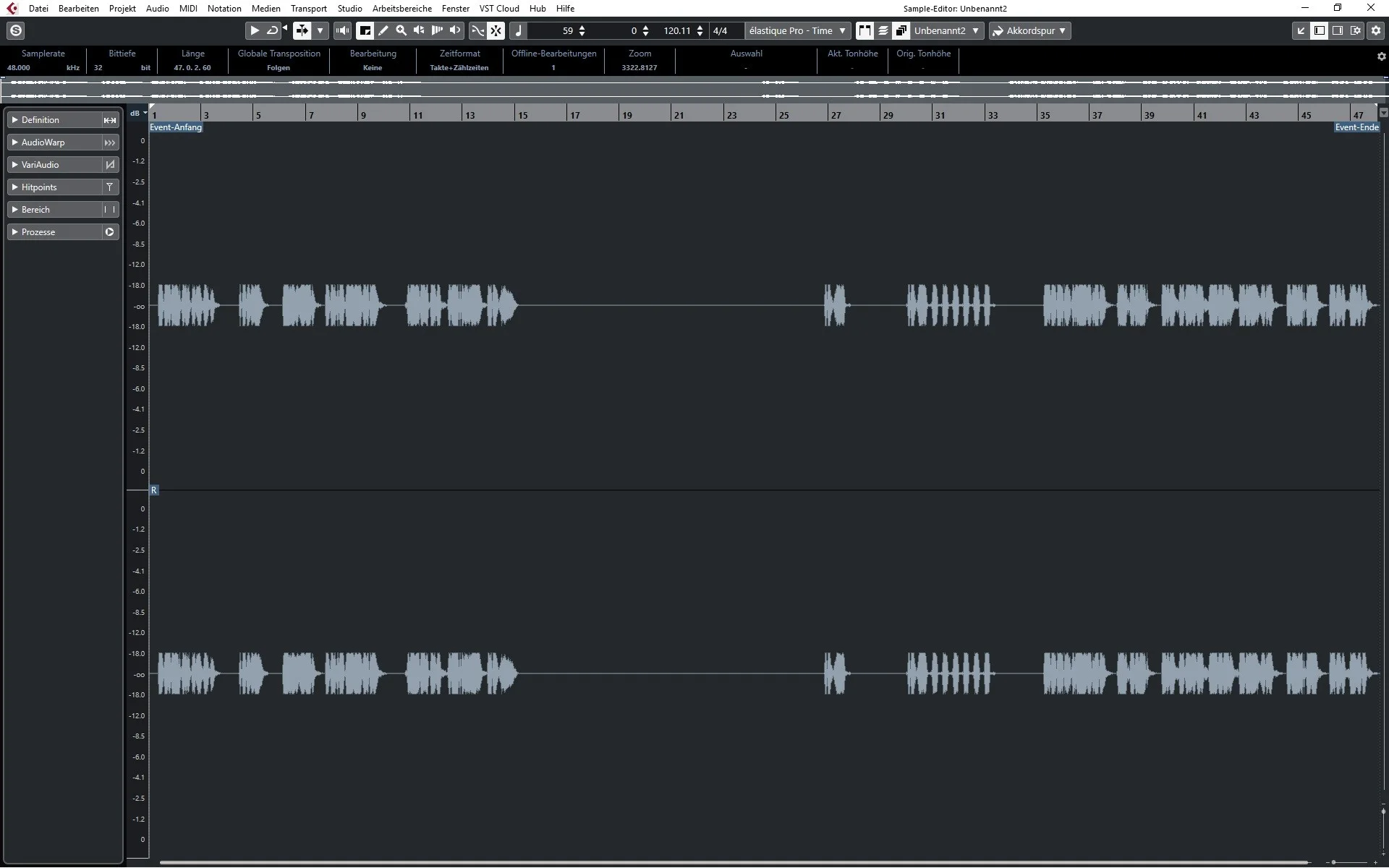 Limiter.webp